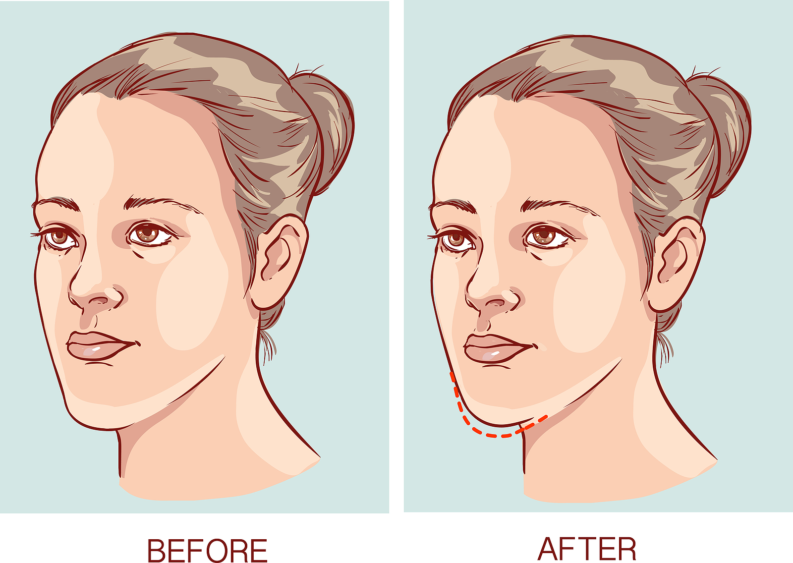 Oral and Maxillofacial Surgery in Temecula, CA